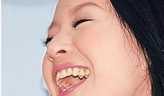 笑不露齿,笑不露齿的魅力解析